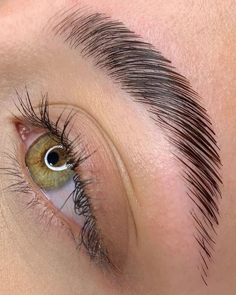 Exemple de browlift