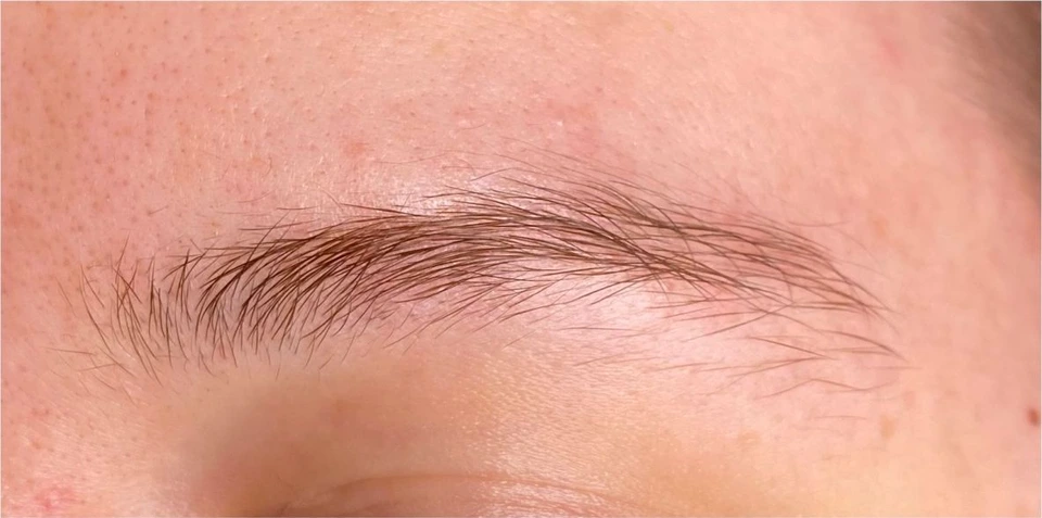 Browlift : avant le soin