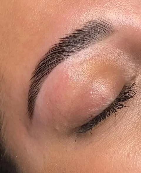 Exemple de browlift et de sourcils redessinés